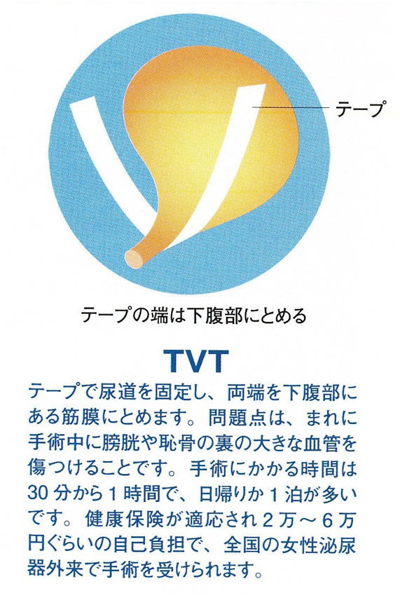 尿失禁・性器脱・便失禁専門クリニック