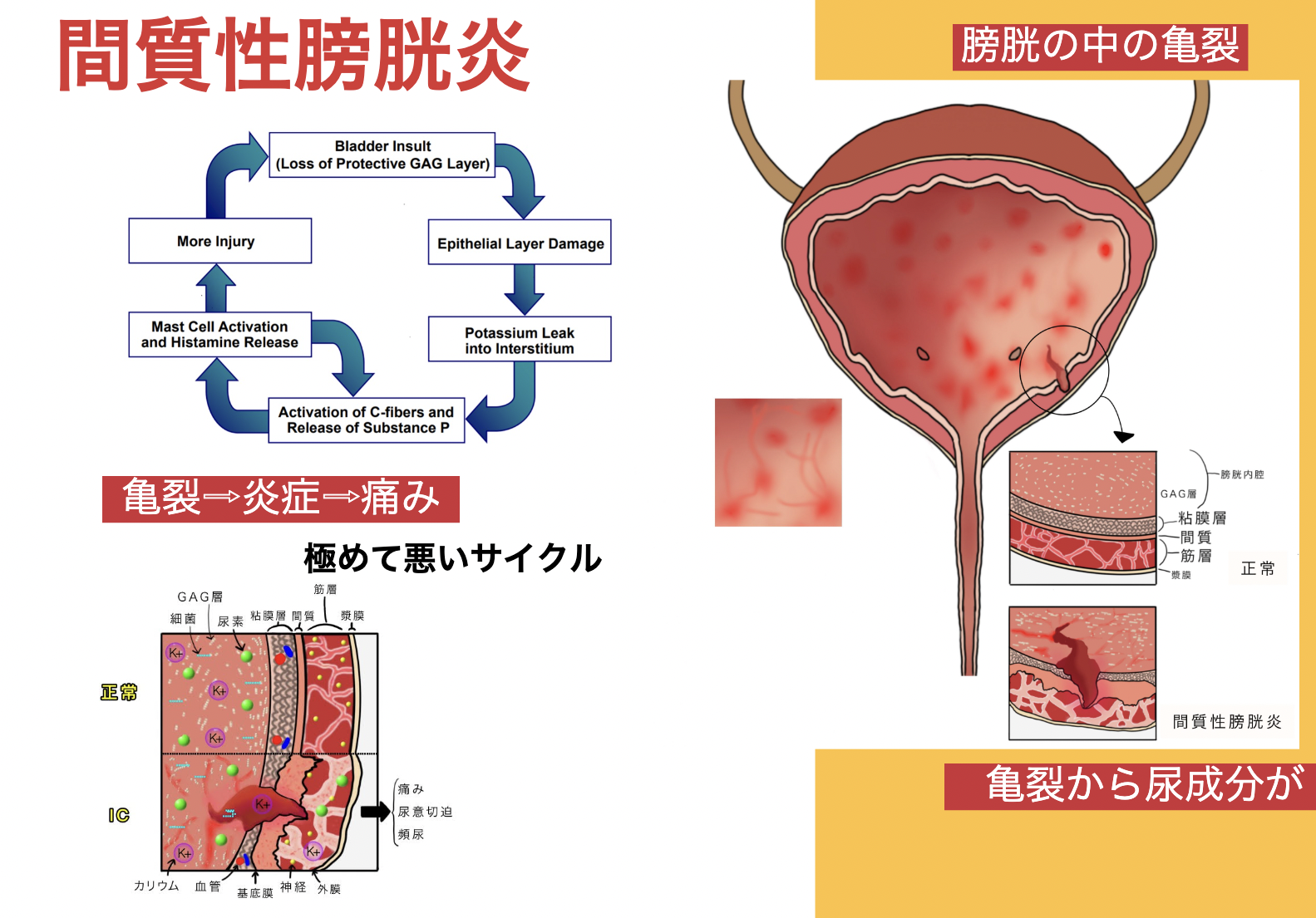 二次元子宮脱 拡張 タイトル: 間質性膀胱炎・骨盤痛への取り組み - よこすか女性泌尿器科 ディスクリプション:  非常に熱心に取り組むよこすか女性泌尿器科が新しいアプローチで間質性膀胱炎と骨盤痛に取り組んでいます。詳細をご覧ください。
